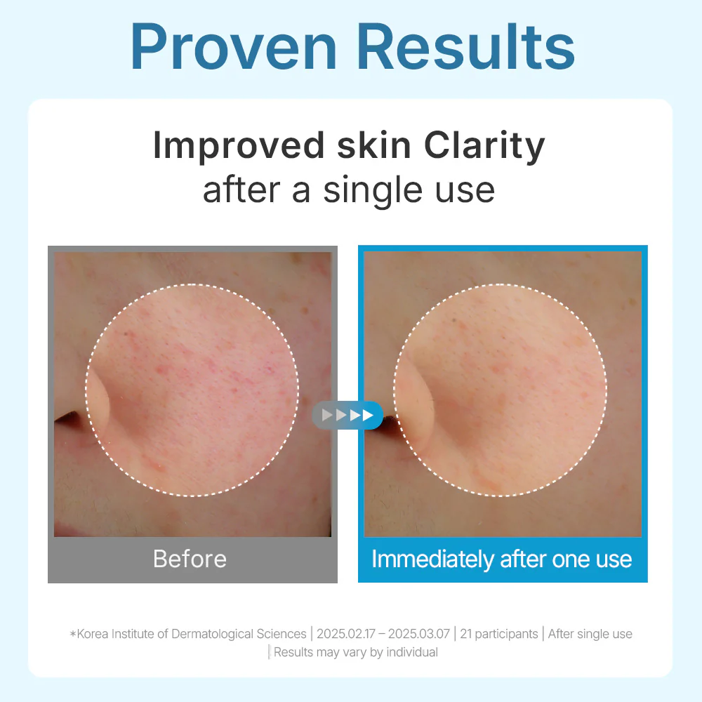 Madeca Lab Hyal Waterfull Glow Gel Mask 5ea - Image 3